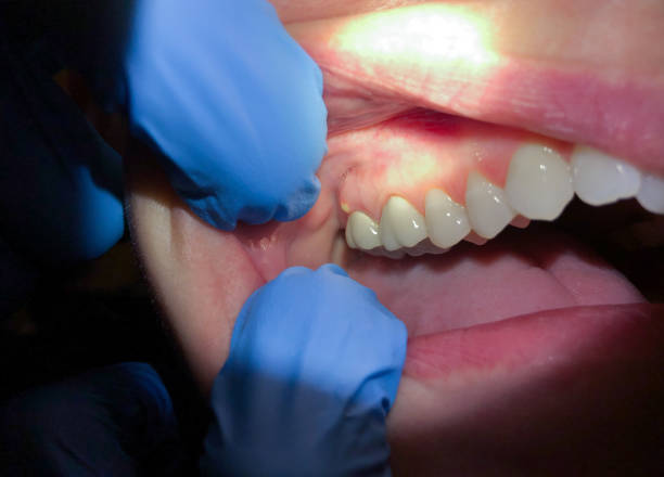 Best After-Hours Emergency Dentist in Silver Spring, MD