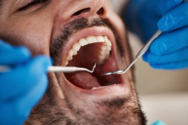 Best Weekend Emergency Dentist in Silver Spring, MD