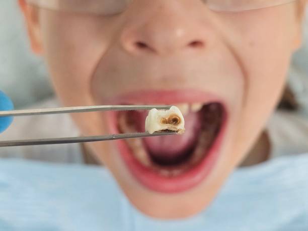 Best Weekend Emergency Dentist in Silver Spring, MD