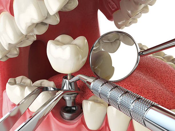 Fast & Reliable Emergency Dental Services in MD