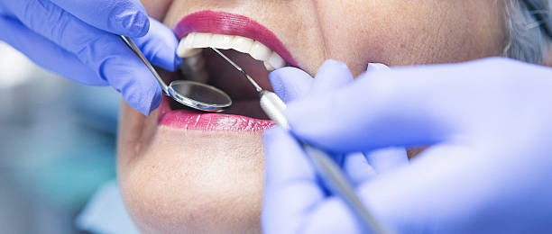Best Emergency Tooth Extraction in Silver Spring, MD